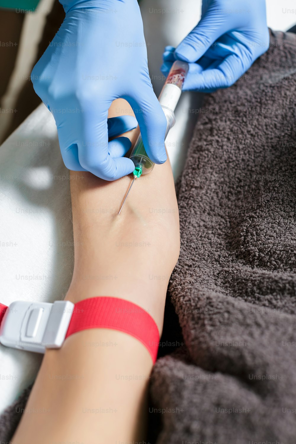 infermiera che preleva un campione di sangue dal braccio del paziente. Preparazione del sangue alla procedura Plasmolifting.