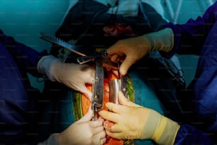 Utilisation de différents outils chirurgicaux pendant l’opération en gros plan