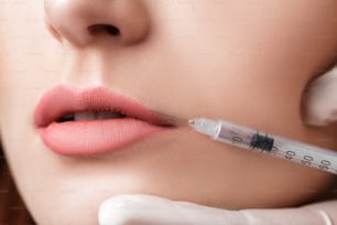 Portrait d’une belle femme recevant une injection sur les lèvres. Injections de beauté et cosmétologie