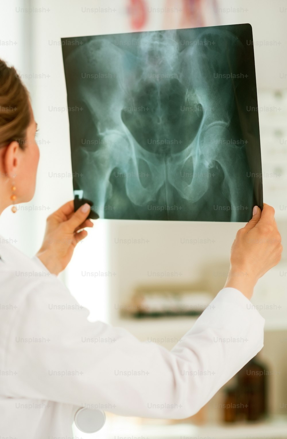 Femme médecin regardant la radiographie. Vue arrière