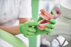 Il dentista mostra come l'apparecchio corregge i denti utilizzando un modello di mascella artificiale.