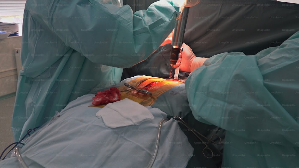 Lung surgery surgeon and team perform thoracic surgery in lung cancer