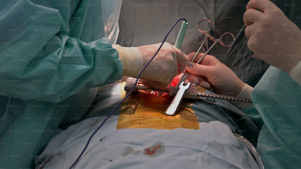 Sutura de una cirugía de enfisema pulmonar en un lactante y asistencia médica de cerca
