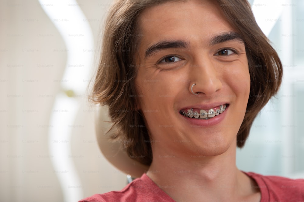 Sonrisa dentada. Paciente masculino caucásico joven de cabello oscuro con aparatos dentales sonriendo mientras mira frente a él