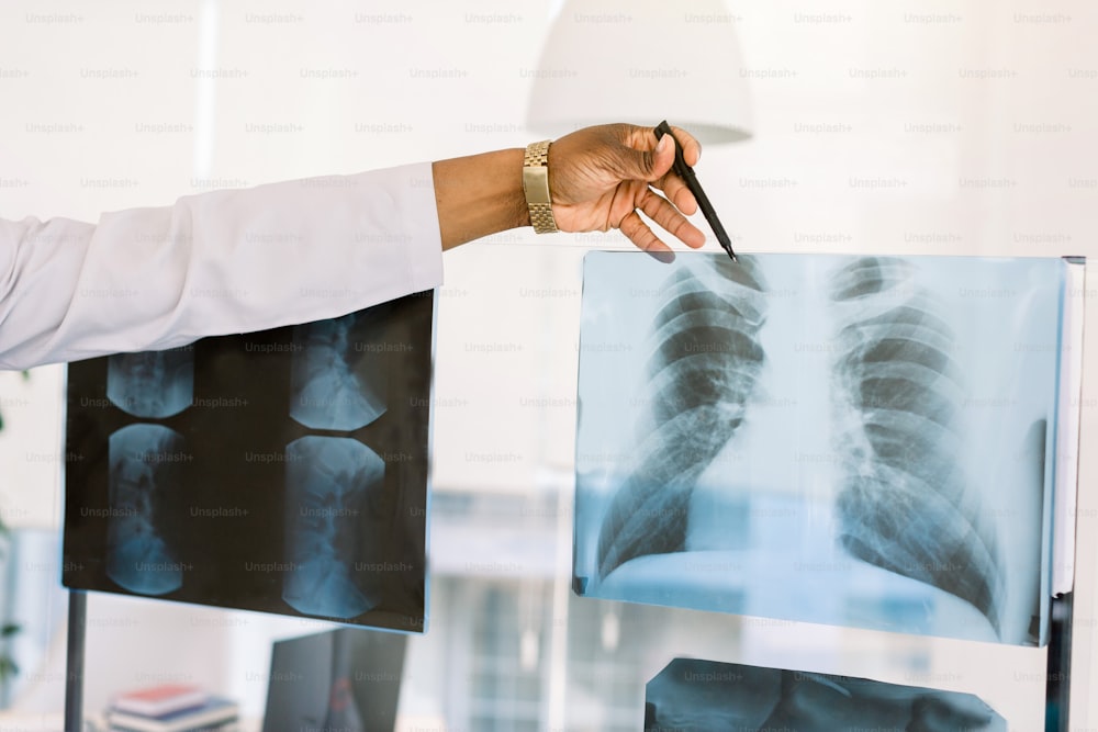 Travailleur de la santé afro-américain avec radiographie. Image recadrée de la main d’un médecin africain pointant vers l’image radiologique de la poitrine du patient.
