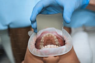 Close up da boca aberta da fêmea enquanto o médico está usando espelho para um melhor exame dos dentes
