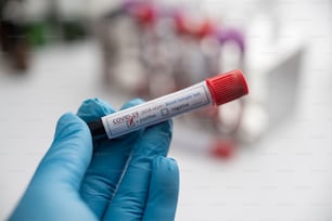 hands of a lab technician with a tube of blood sample and a rack with other samples / lab technician holding blood tube sample for study