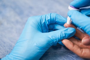 Be careful. Close up of practitioner that wearing sterile gloves while working with patients