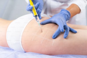 Beschnittenes Foto eines Dermatologen, der das Auftreten von Cellulite auf dem Gesäß der jungen Frau minimiert