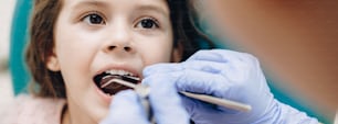 치과 의사가 입을 벌린 작은 백인 소녀에게하는 치아 검사 절차