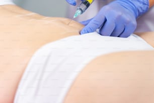 Foto recortada de una paciente a la que un dermatólogo le administra una inyección en la parte inferior del abdomen