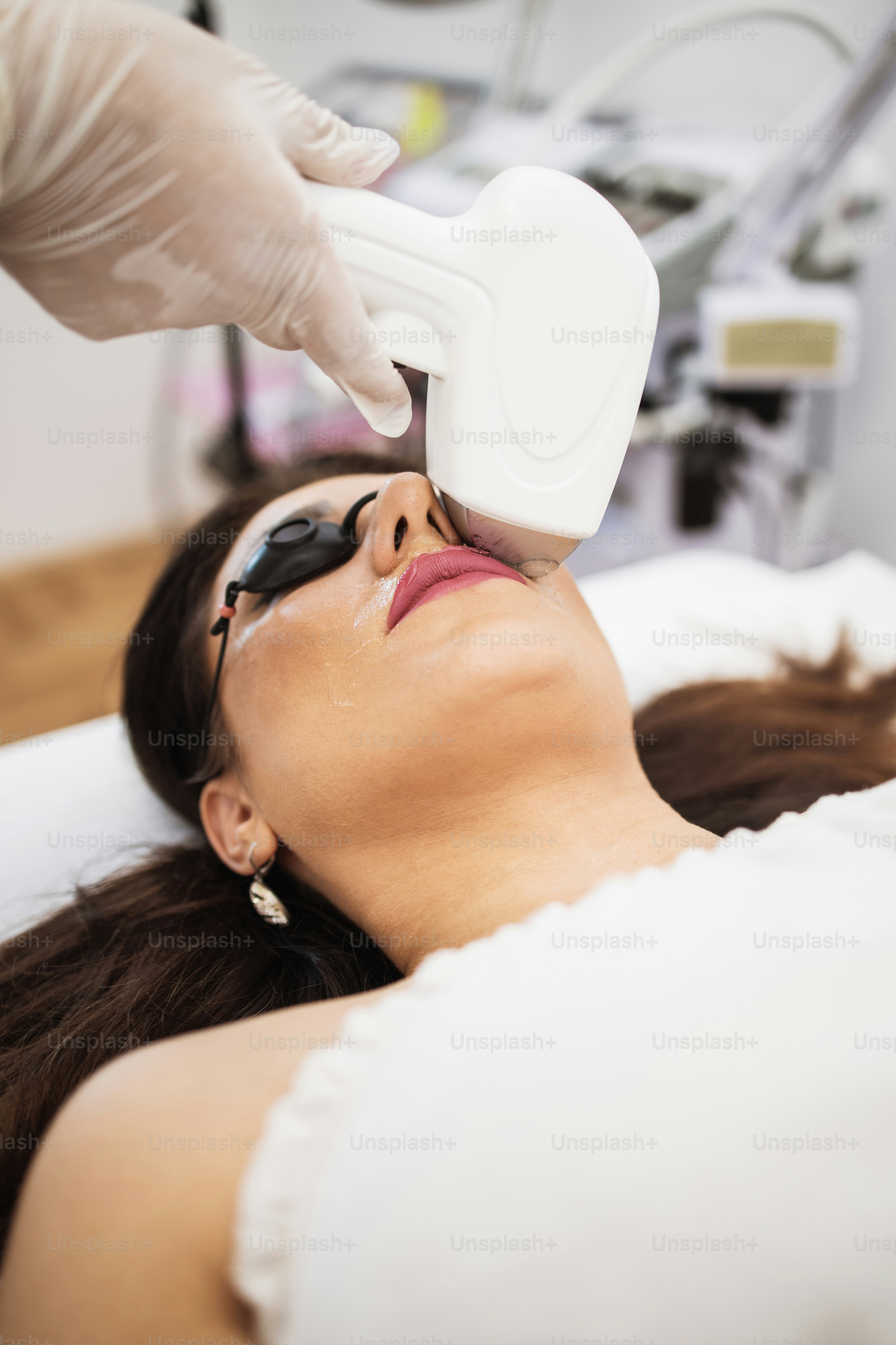 Giovane bella donna che riceve il trattamento di epilazione della pelle del viso. Moderno concetto di cura del corpo e cosmetica.