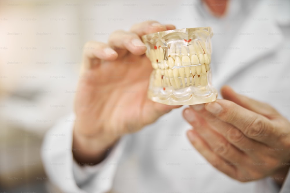 Nahaufnahme von Arzthänden, die ein Vollkiefer-Zahnimplantat halten