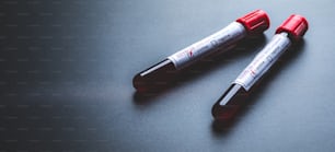 Análisis de sangre de coronavirus COVID-19 en tubo de ensayo, laboratorio científico para el desarrollo de vacunas y medicamentos antivirales, y pruebas de virus humanos