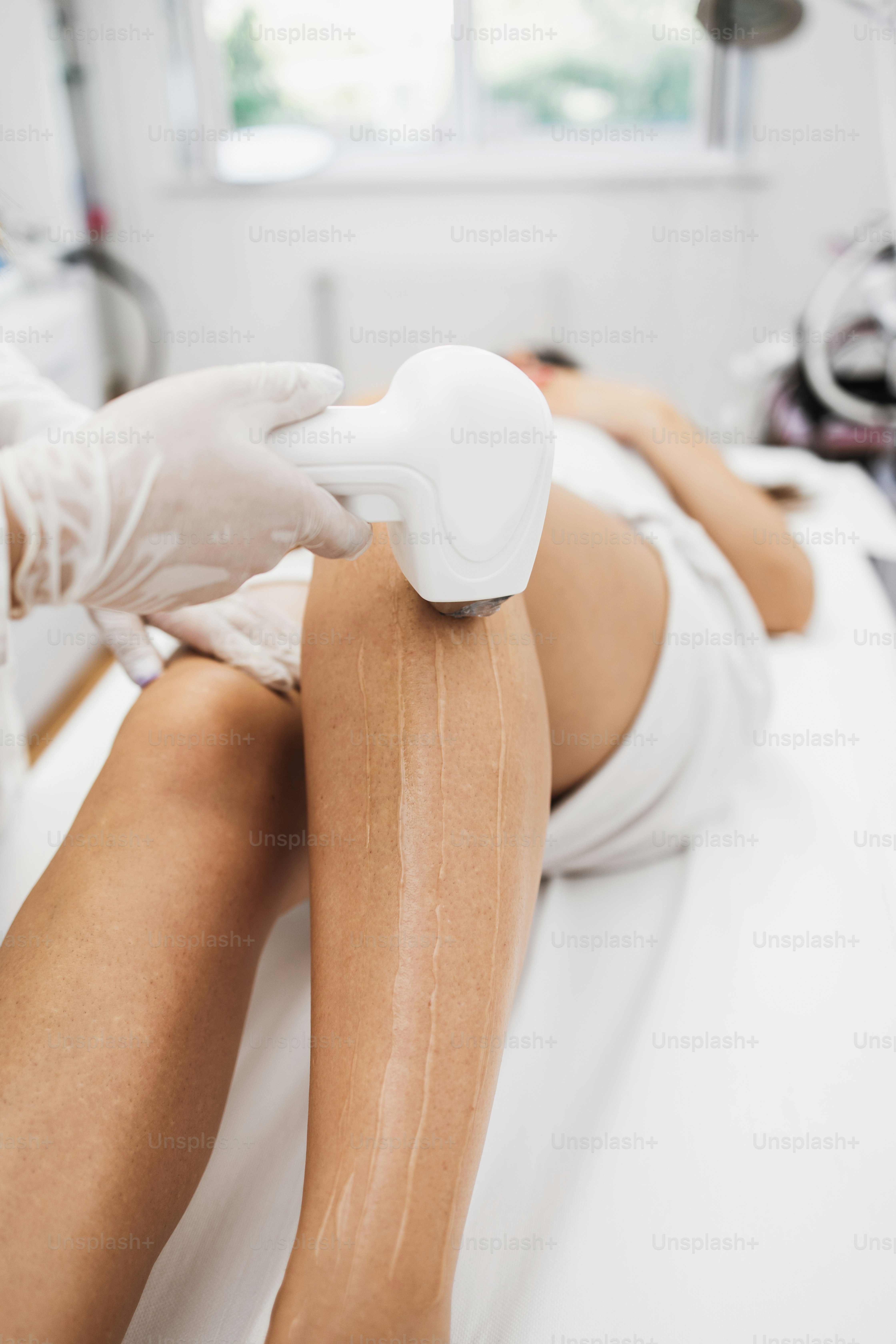 Laser hair removal pros and cons 2024