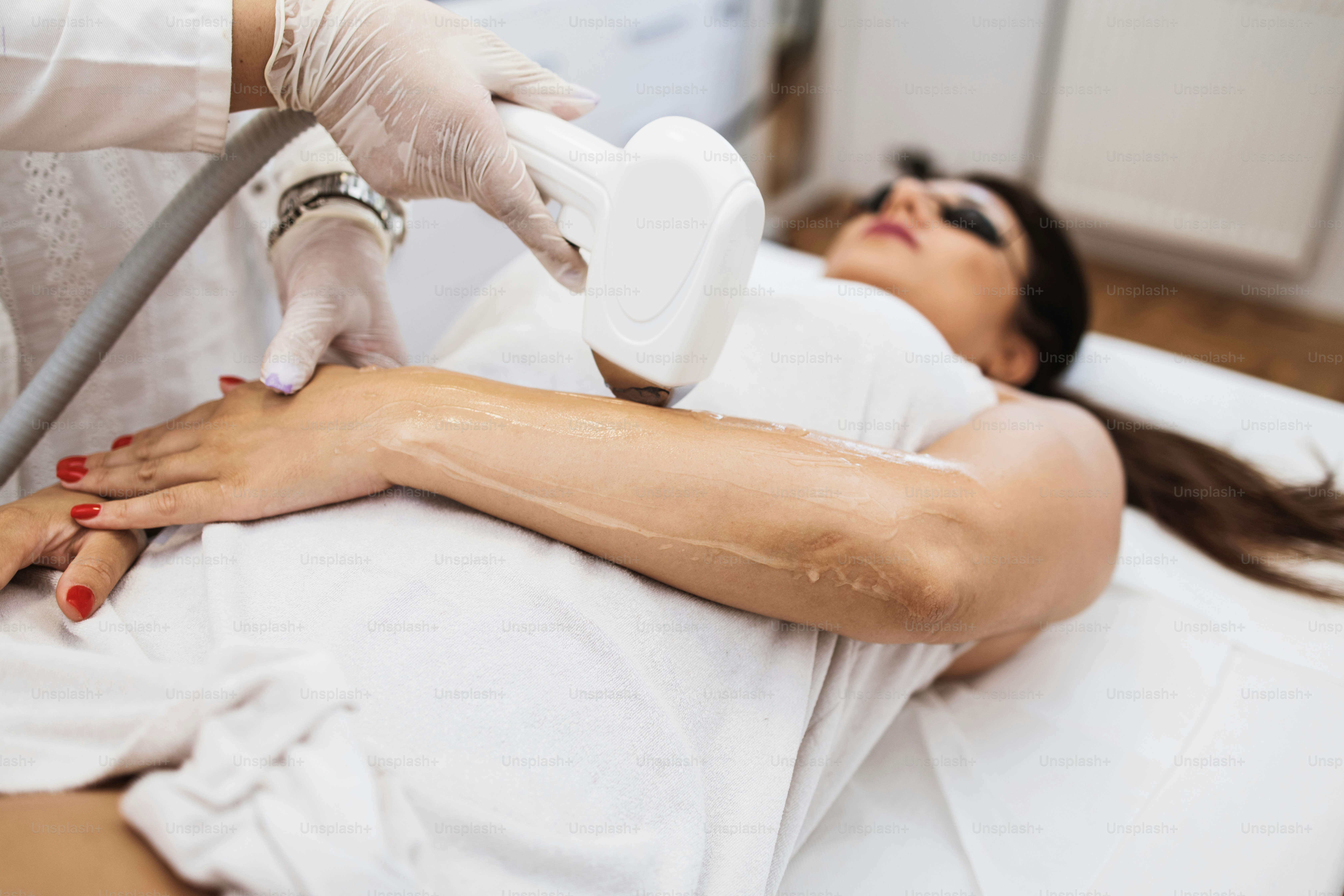 Giovane bella donna che riceve il trattamento di epilazione della pelle del braccio e del corpo. Moderno concetto di cura del corpo e cosmetica.