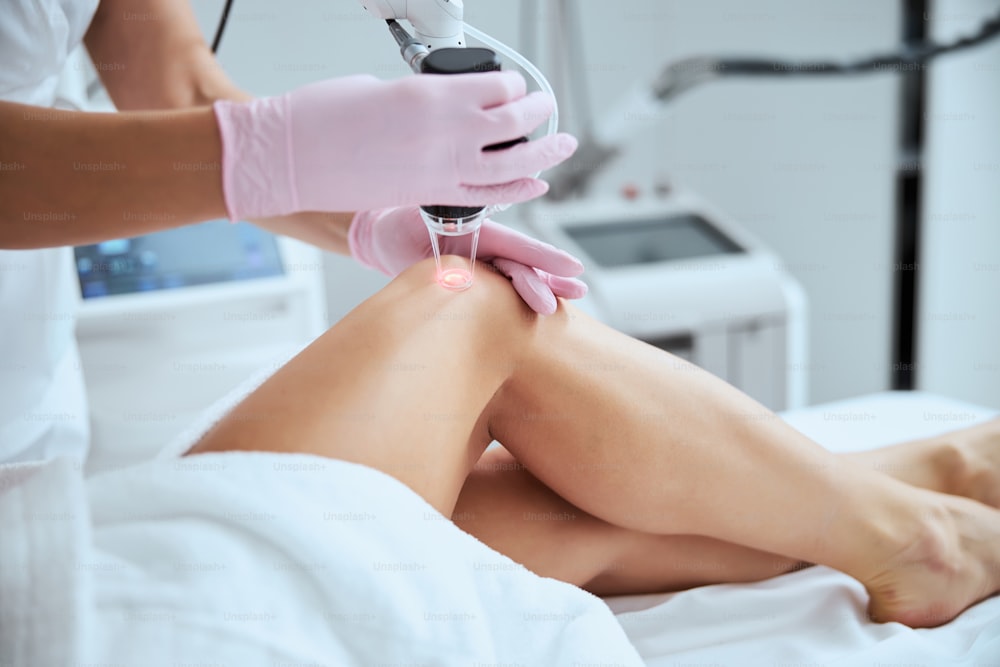Cropped photo of a woman patient being treated for spider veins in a wellness center