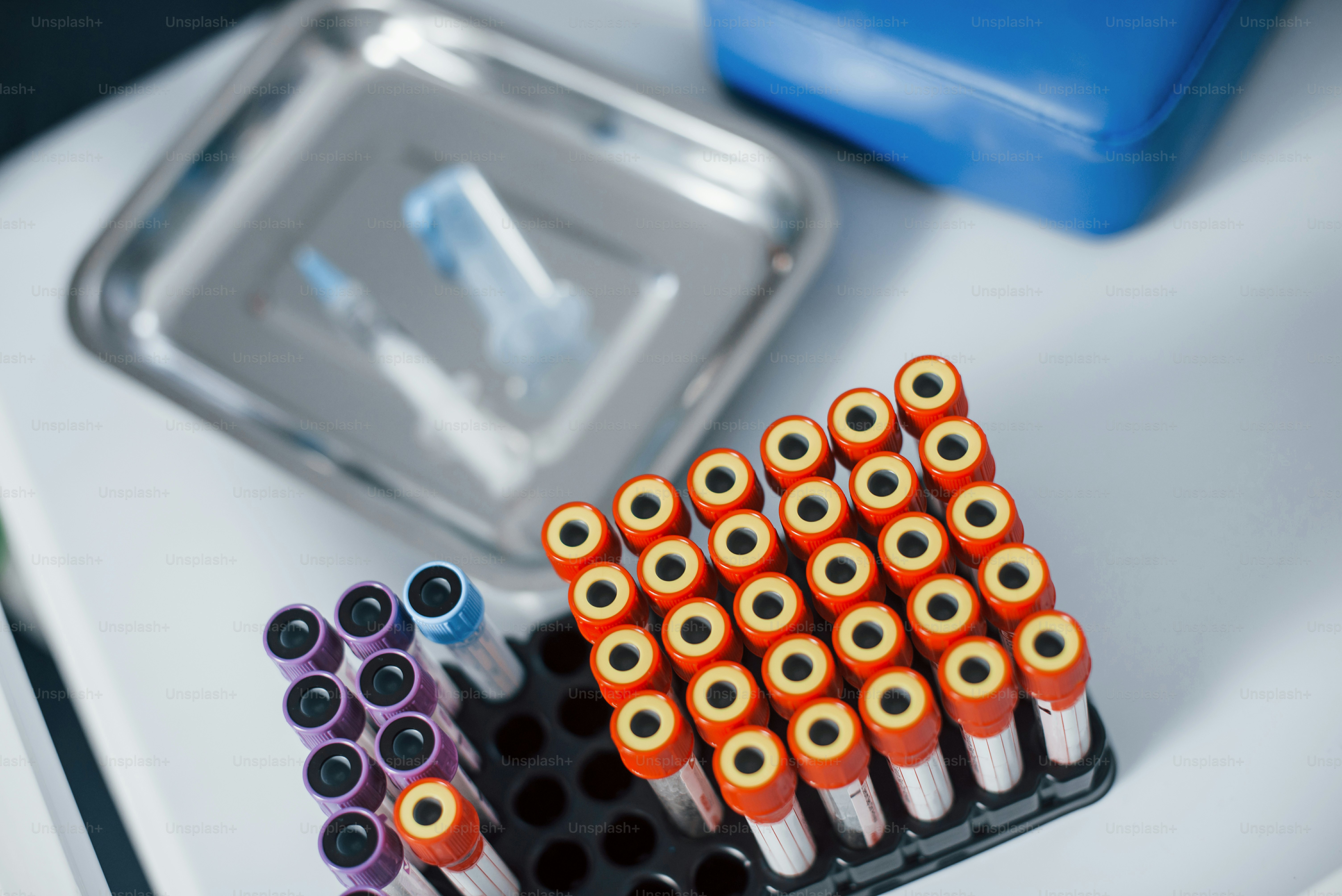 Top view of vials with medical experimental liquid that stands on white surface.