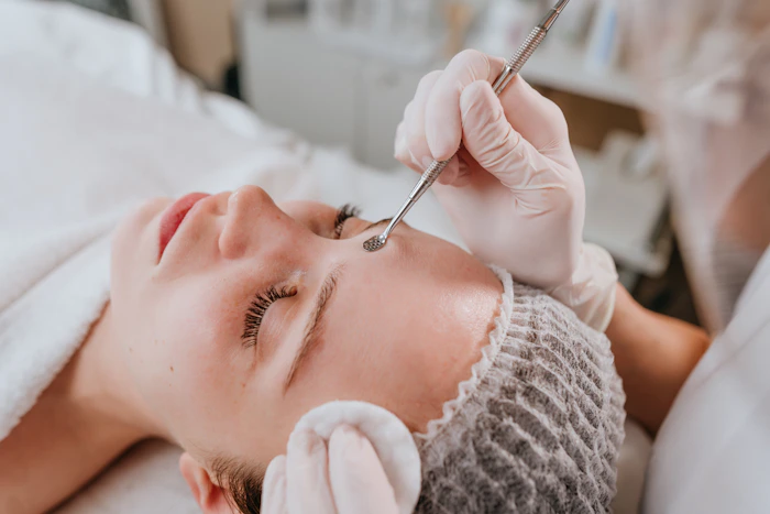 Esthéticienne réalisant un soin d'extraction ciblé sur le visage