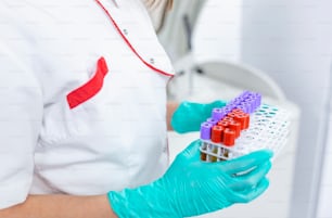 hand of a lab technician holding blood tubes test and background a rack of color tubes with blood samples other patients / laboratory technician holding a blood tube test