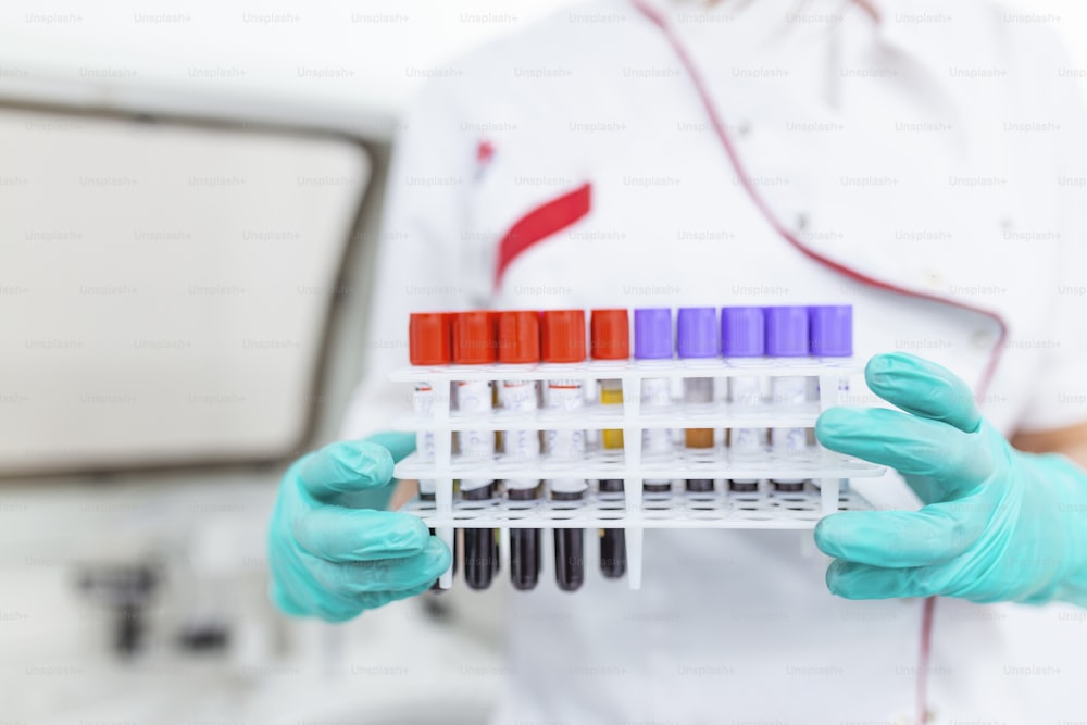 Technician holding blood tube test in the research laboratory. Coronavirus testing. Doctor taking a blood sample tube from a rack in the lab