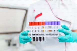 Technician holding blood tube test in the research laboratory. Coronavirus testing. Doctor taking a blood sample tube from a rack in the lab