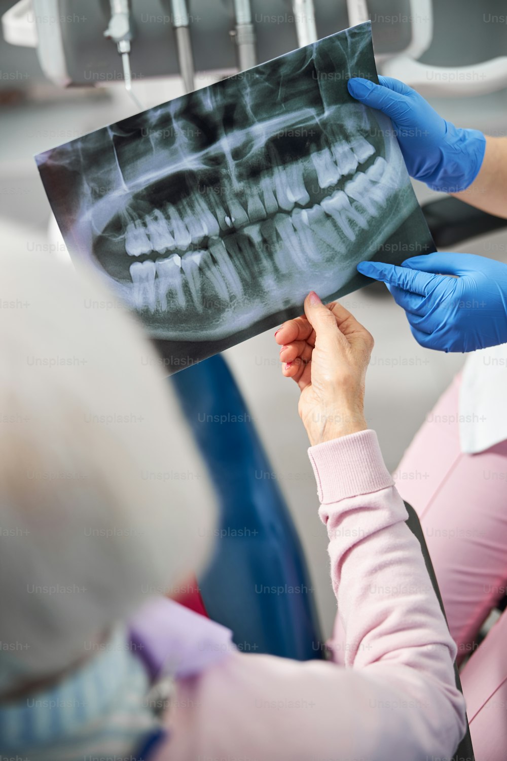 Alternde Frau, die eine Röntgenaufnahme des Kiefers vor sich hält, während der Zahnarzt auf einen kranken Zahn hinweist