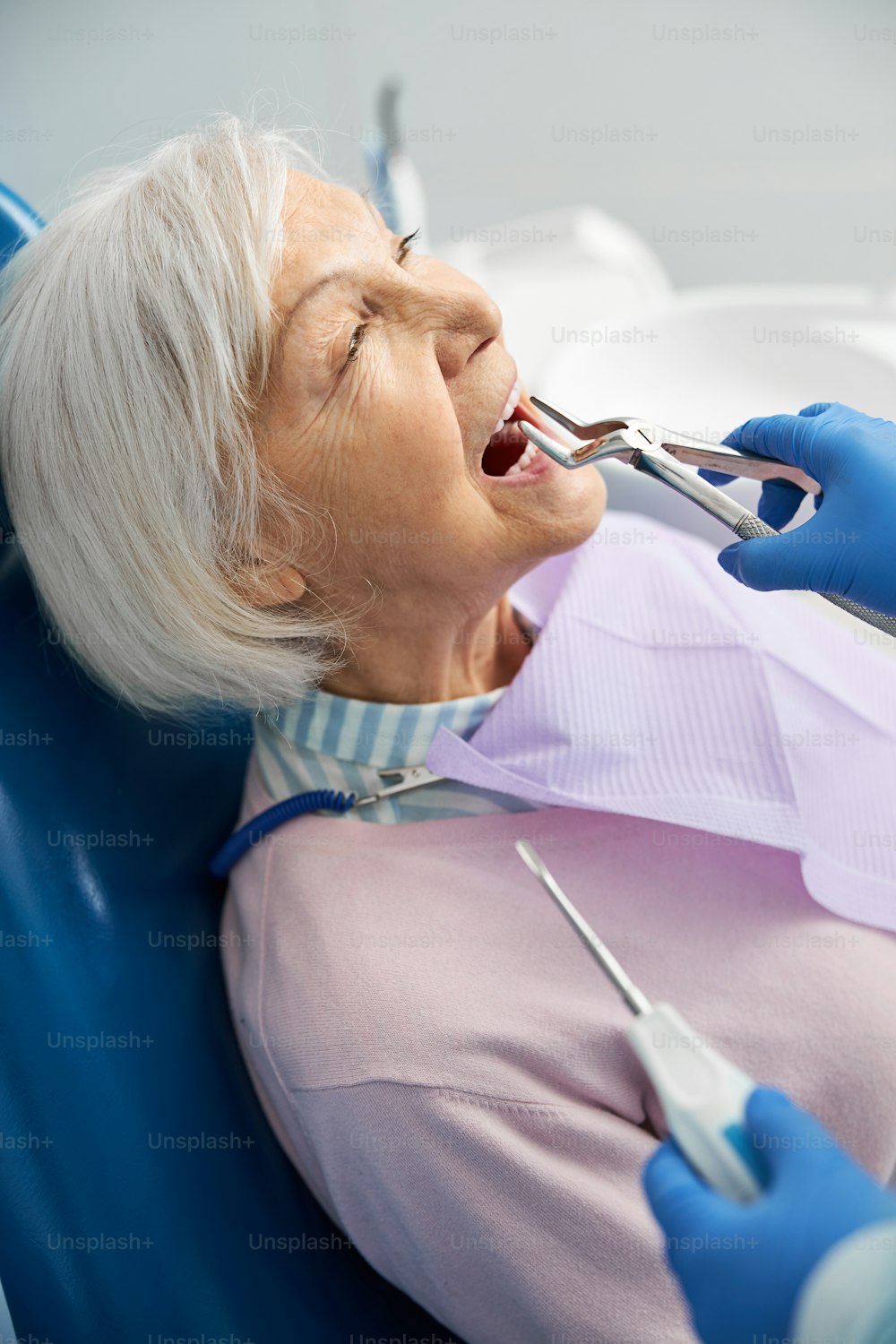 Operación de extracción del diente de la mandíbula superior con pinzas dentales mientras se lleva la herramienta elevadora a la boca