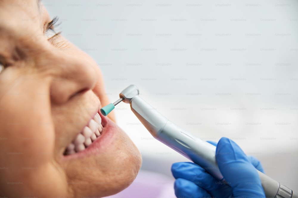 Handpiece with blue prophy cup on its drill whitening the teeth of aging lady