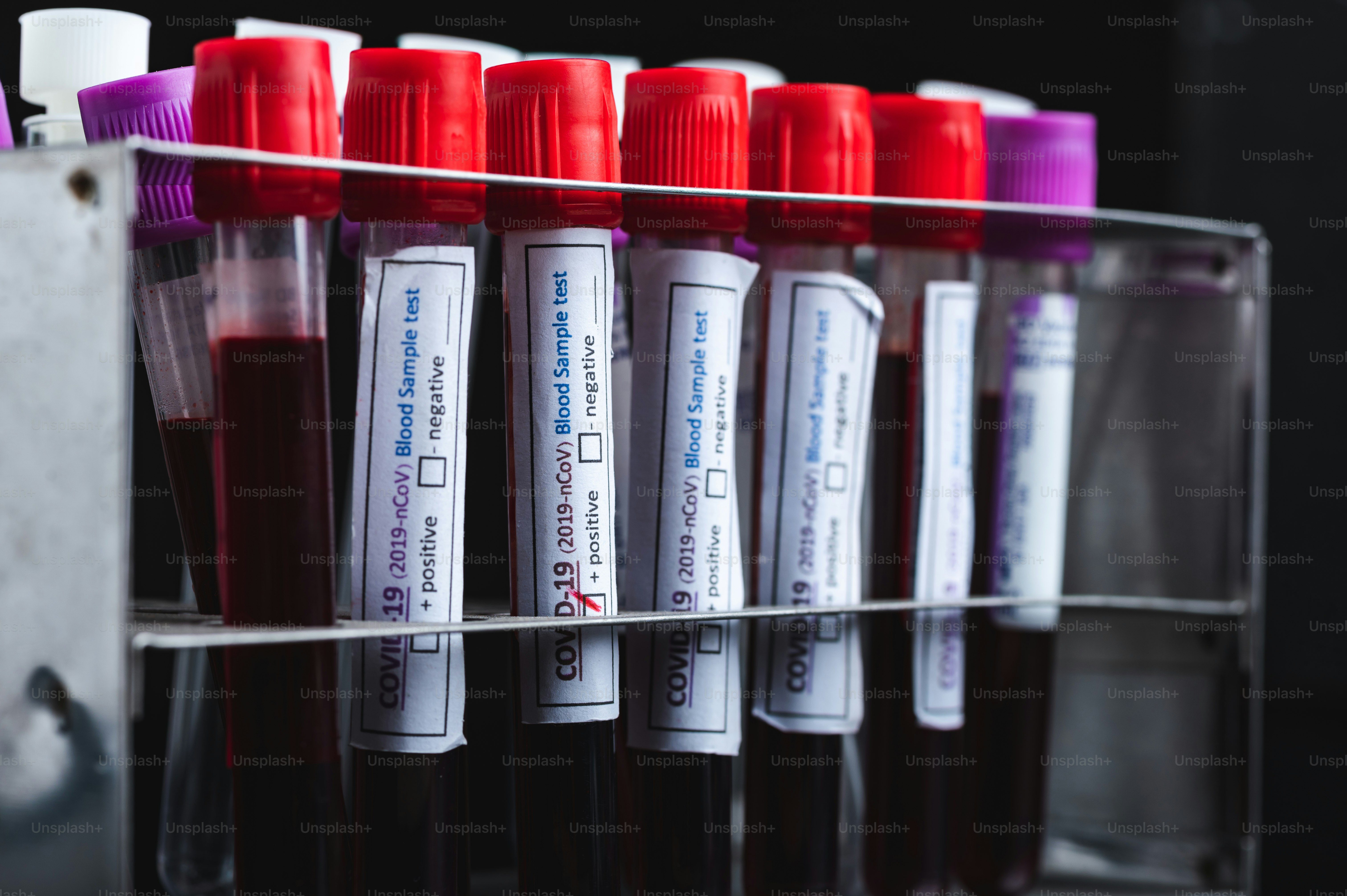 COVID-19 Coronavirus header background.