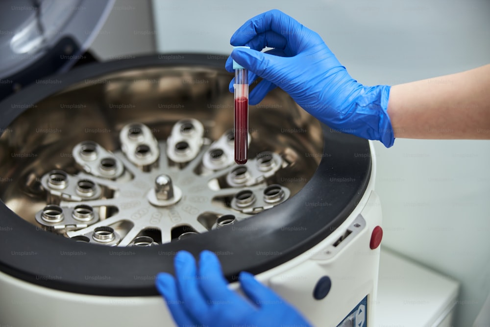 라텍스 장갑을 낀 생화학자가 혈액 샘플이 있는 vacutainer를 원심분리기에 넣는 자른 사진