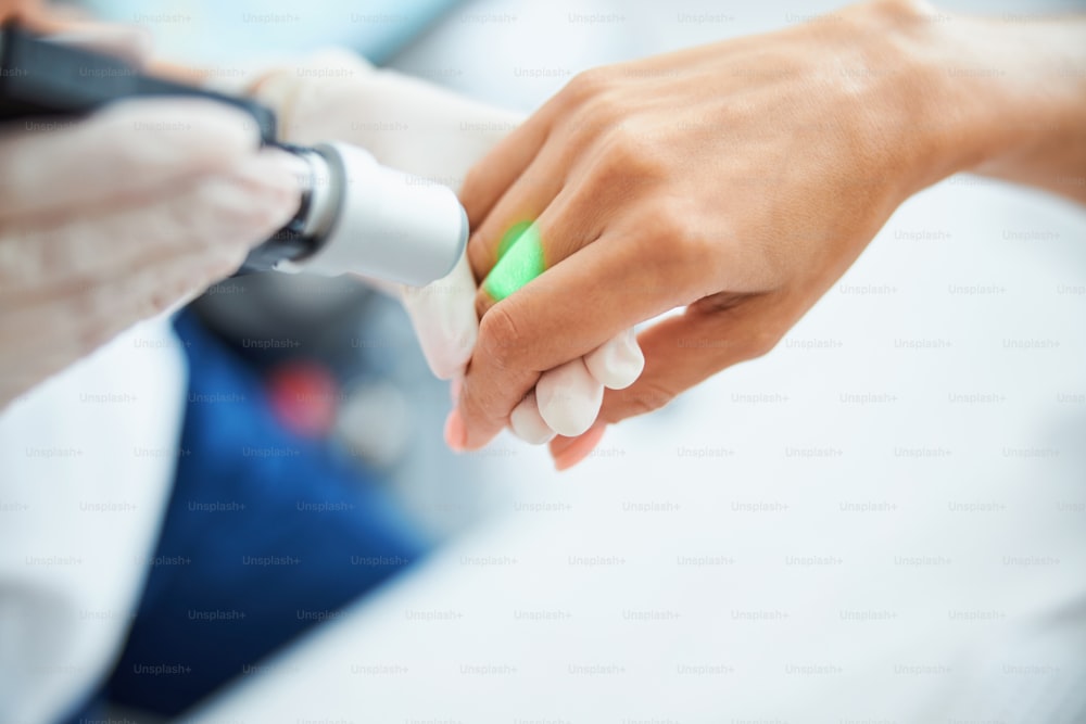 Beschnittenes Foto eines Dermatologen in Nitrilhandschuhen, der eine Laserepilation an einem weiblichen Finger durchführt