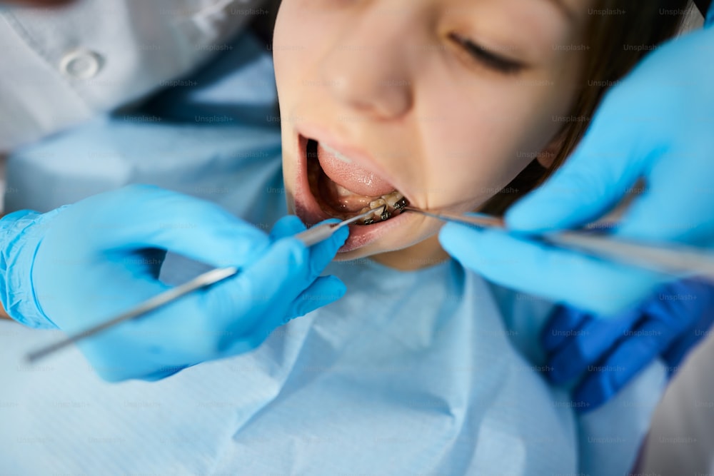 치과에서 치과 의사에게 치아를 검사받는 십대 소녀의 클로즈업.