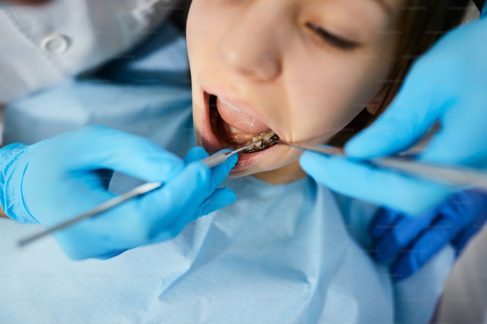 Gros plan d’une adolescente se faisant examiner les dents par un dentiste à la clinique dentaire.