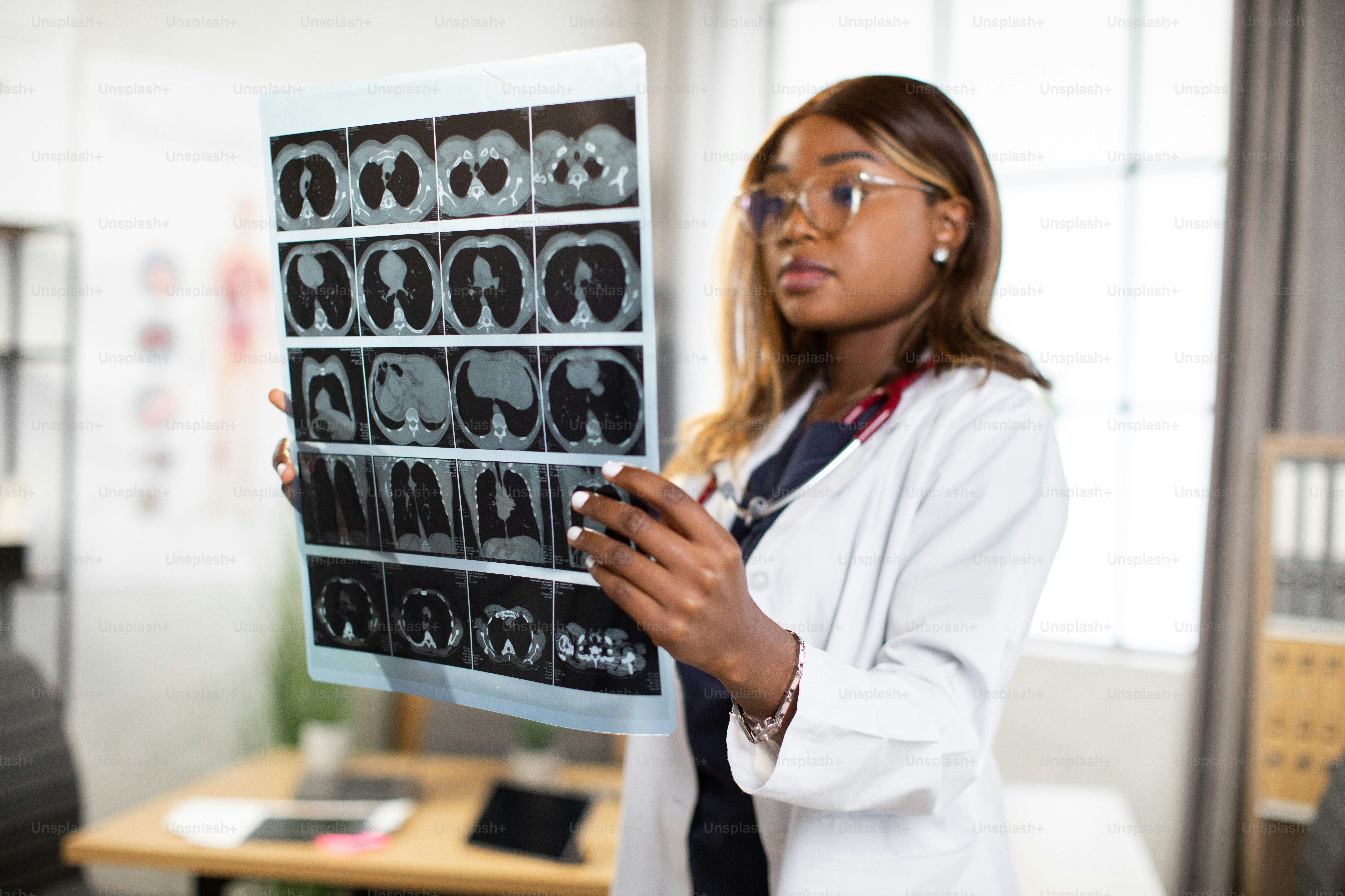 Close up of young confident afro-american female physician looking at computer tomography x-ray image, while standing in modern bright medical office. Selective focus on MRI scan