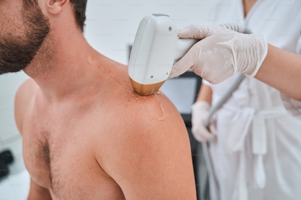 Foto cortada de um homem barbudo de cabelos escuros sentado durante o tratamento de depilação a laser do ombro feito por uma dermatologista do sexo feminino