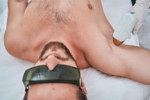Hombre barbudo con bigote y gafas de seguridad acostado en el sofá durante un procedimiento médico no invasivo realizado por una cosmetóloga
