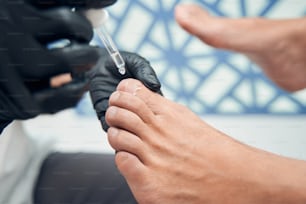 Primo piano delle mani dell'estetista sui guanti sterili che versa l'essenza di riparazione delle unghie sul piede maschile mentre fa la pedicure
