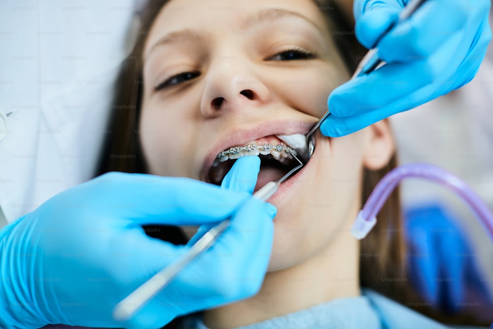 Chiuso del dentista che esamina gli apparecchi dentali di una ragazza adolescente presso la clinica odontoiatrica. n