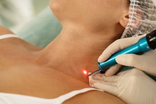 Klientin bei der Laserentfernung von Pigmentflecken oder Muttermalen in einer medizinisch-ästhetischen Klinik