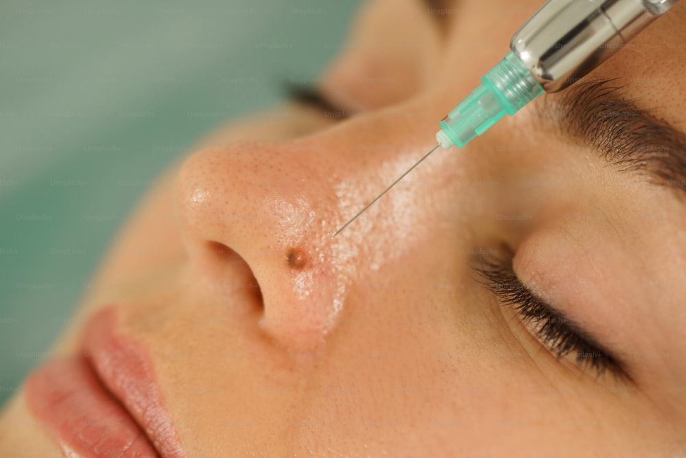 Mulher cliente recebendo injeção de anestésico local antes do tratamento de remoção da toupeira em uma clínica de estética médica