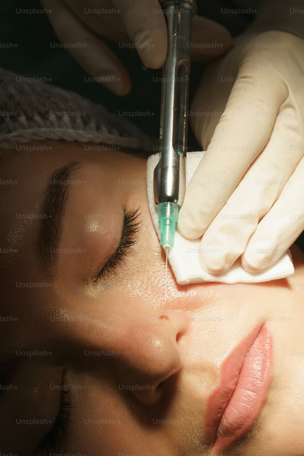 Mujer que recibe una inyección de anestésico local antes del tratamiento de eliminación de lunares en una clínica médico estética
