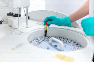 hands of female researcher loading samples in centrifuge in laboratory