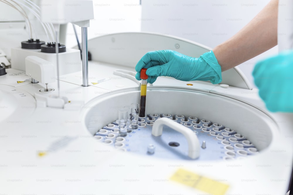 les mains d’une chercheuse chargeant des échantillons dans une centrifugeuse en laboratoire