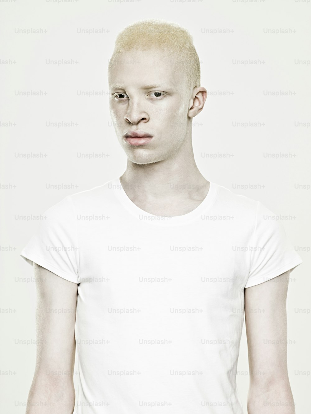 a man with a bald head and a white shirt
