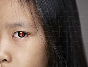 a close up of a child's face with a red eye