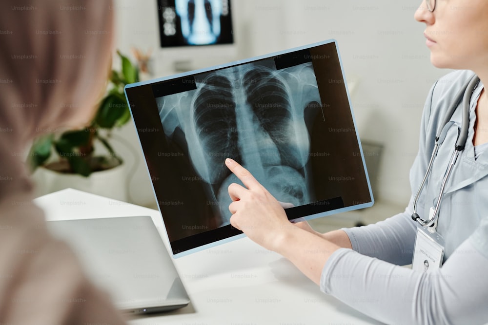 診察中の肺のX線画像を指す若い医師の手と診察結果の説明