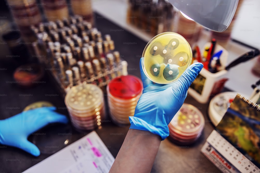 Asistente de laboratorio sentado en el laboratorio y revisando bacterias en placas de Petri.