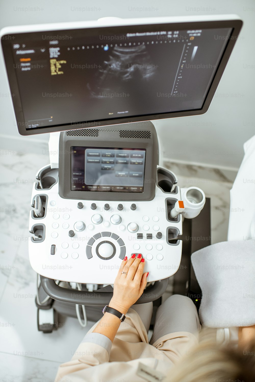 Draufsicht auf das Ultraschallgerät während der ärztlichen Untersuchung