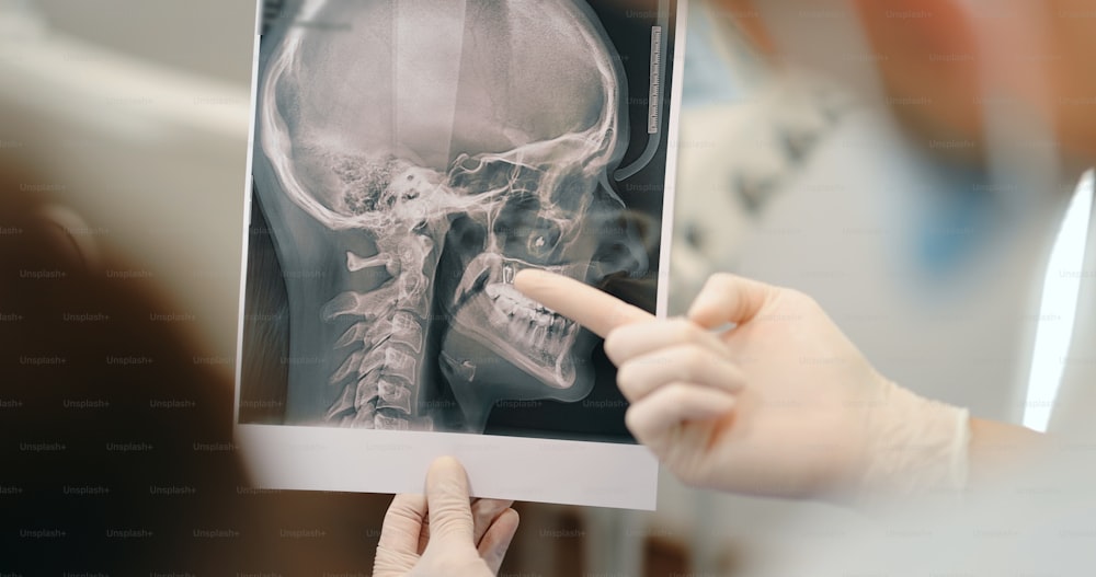 Dentista mostrando una radiografía de cráneo de un paciente joven durante un tratamiento de ortodoncia. Niña que tiene una consulta con un ortodoncista. Captura de pantalla de video 4k, úsela en tamaño pequeño